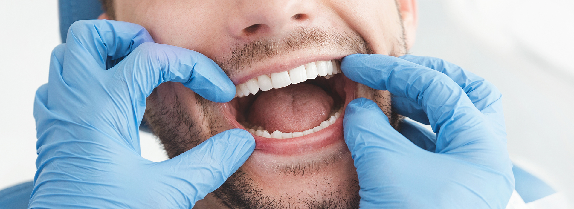 The image shows a man in a dental mask, holding his mouth open with one hand while wearing gloves and a blue surgical gown. He appears to be in a dental or medical setting, possibly preparing for a procedure or examination.