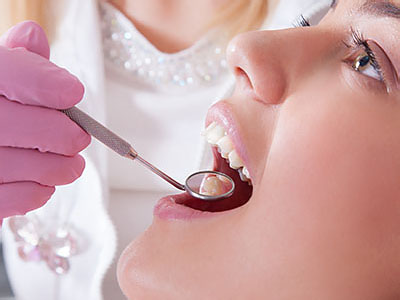 A dental professional performing a teeth cleaning procedure on a patient.